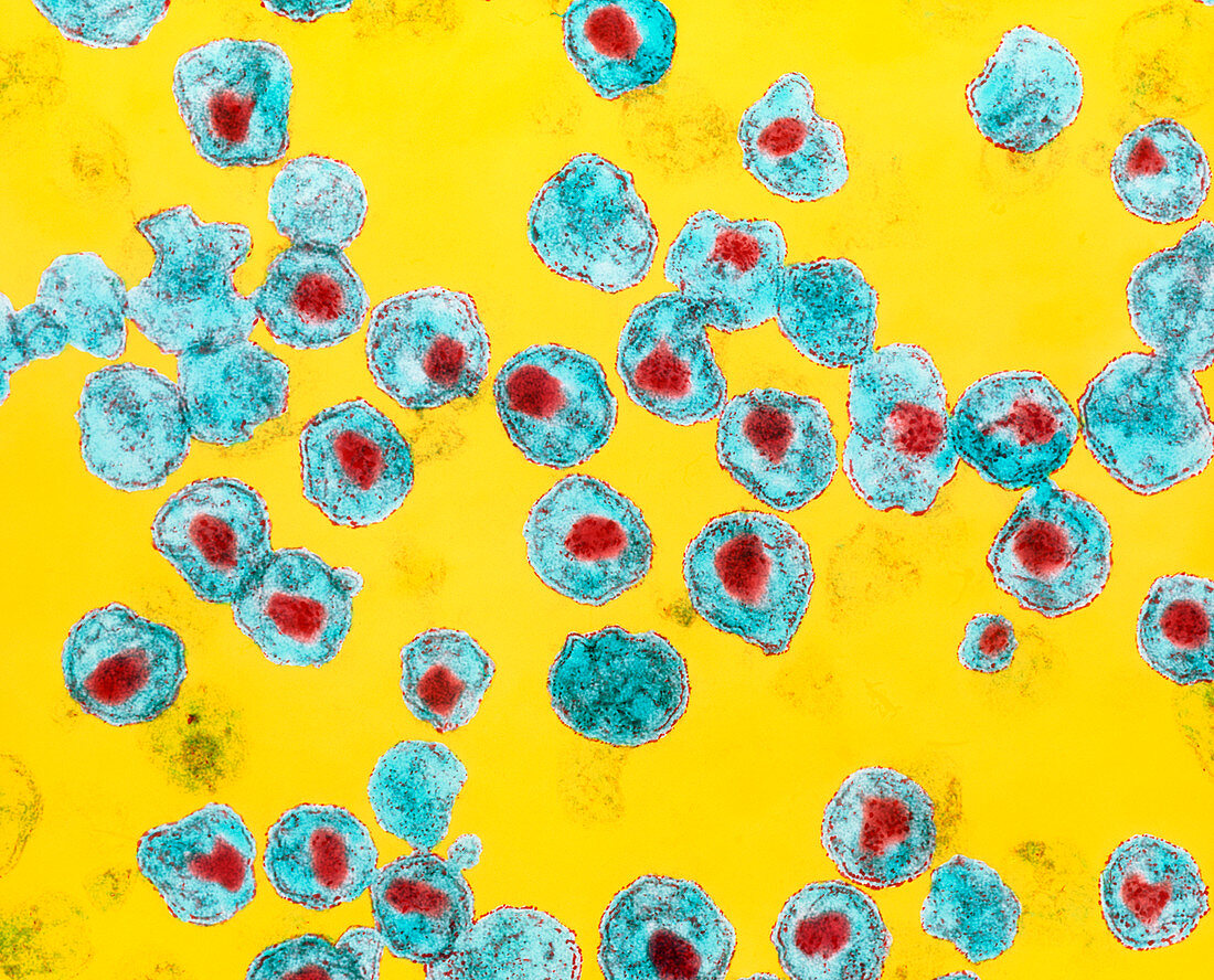 Coloured TEM of HIV-1 viruses