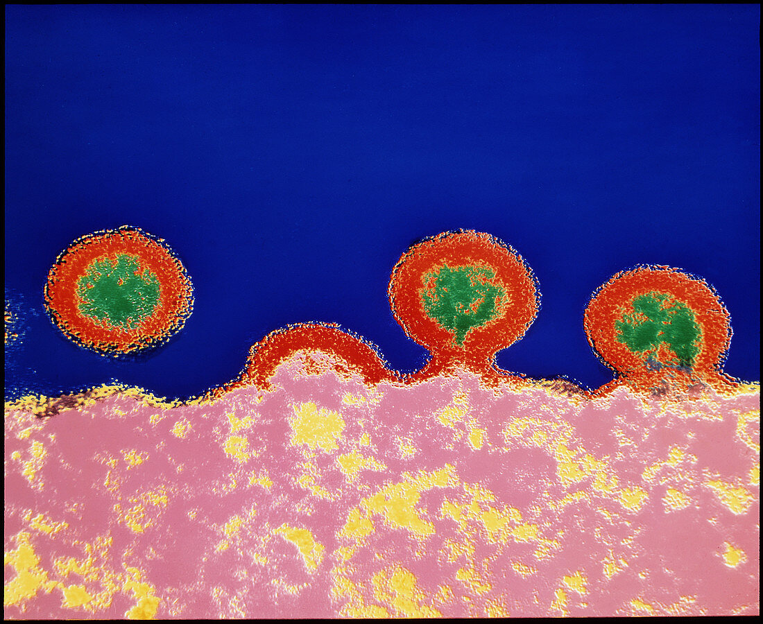Coloured TEM of HIV viruses budding from a T-cell