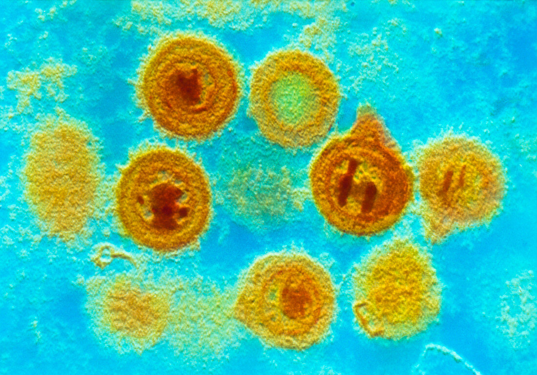 False-colour TEM of Herpes Simplex