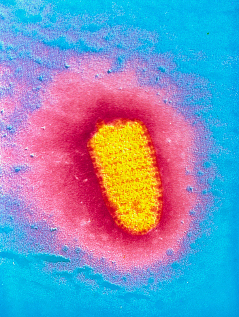 TEM of rabies virus
