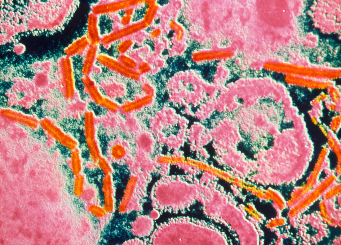 Coloured TEM of parainfluenza virus particles