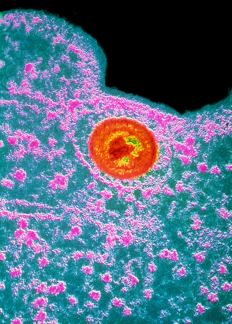 False-col TEM of herpes simplex virus