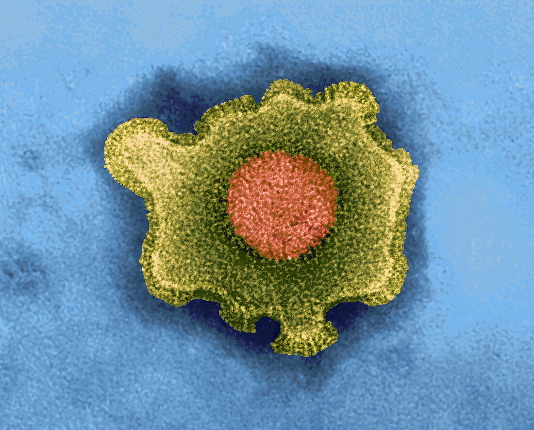 Herpesvirus,TEM