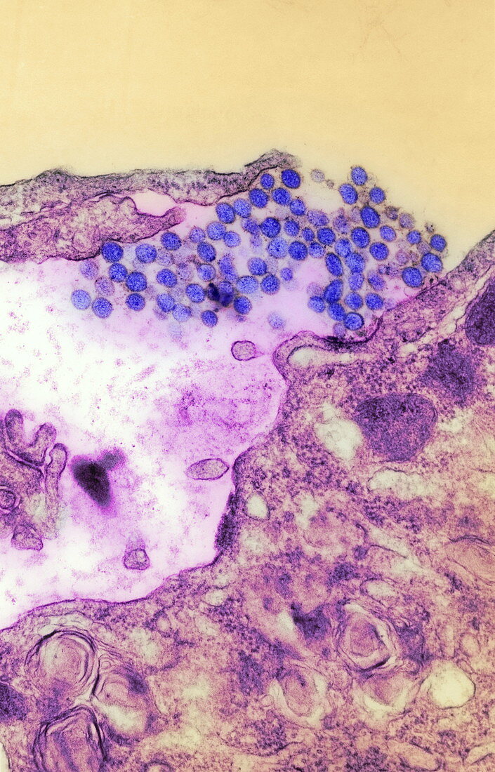 Hantavirus bursting from a cell