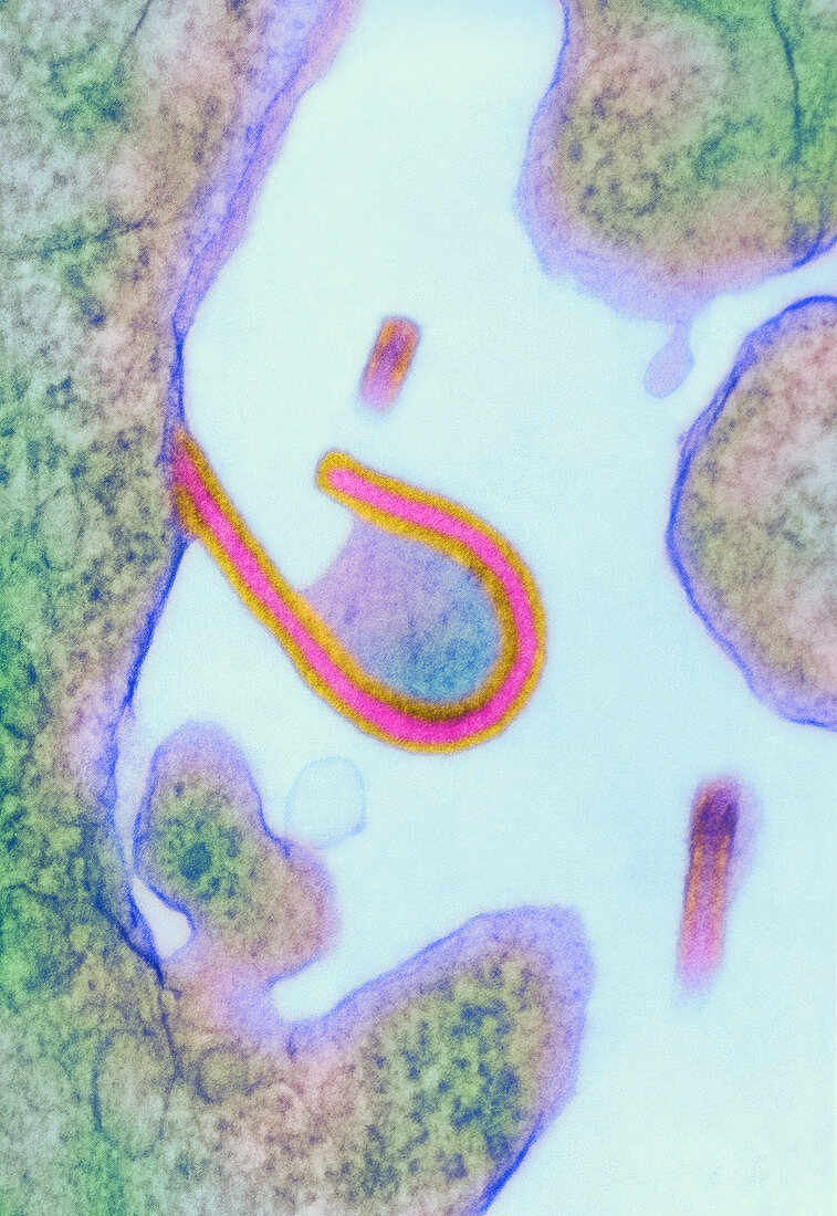 Ebola virus,TEM