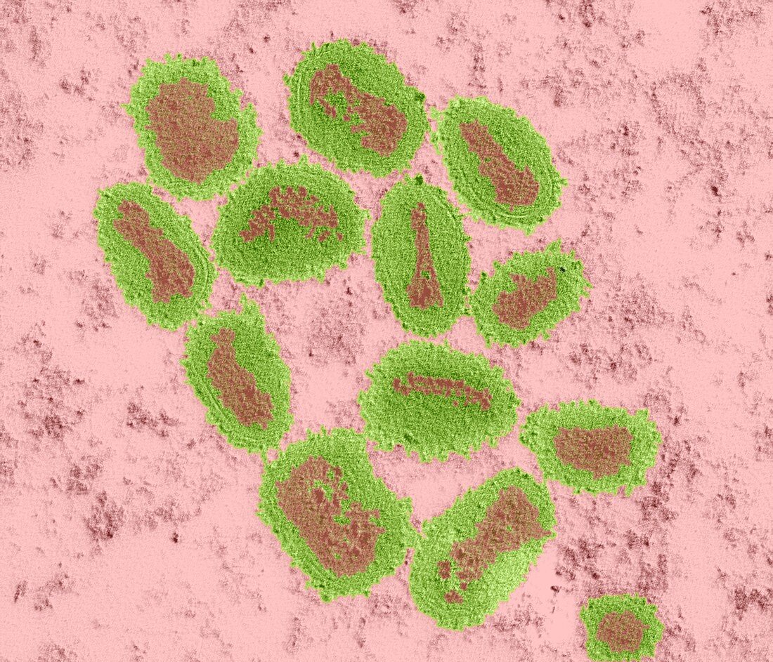 Vaccinia virus particles,TEM