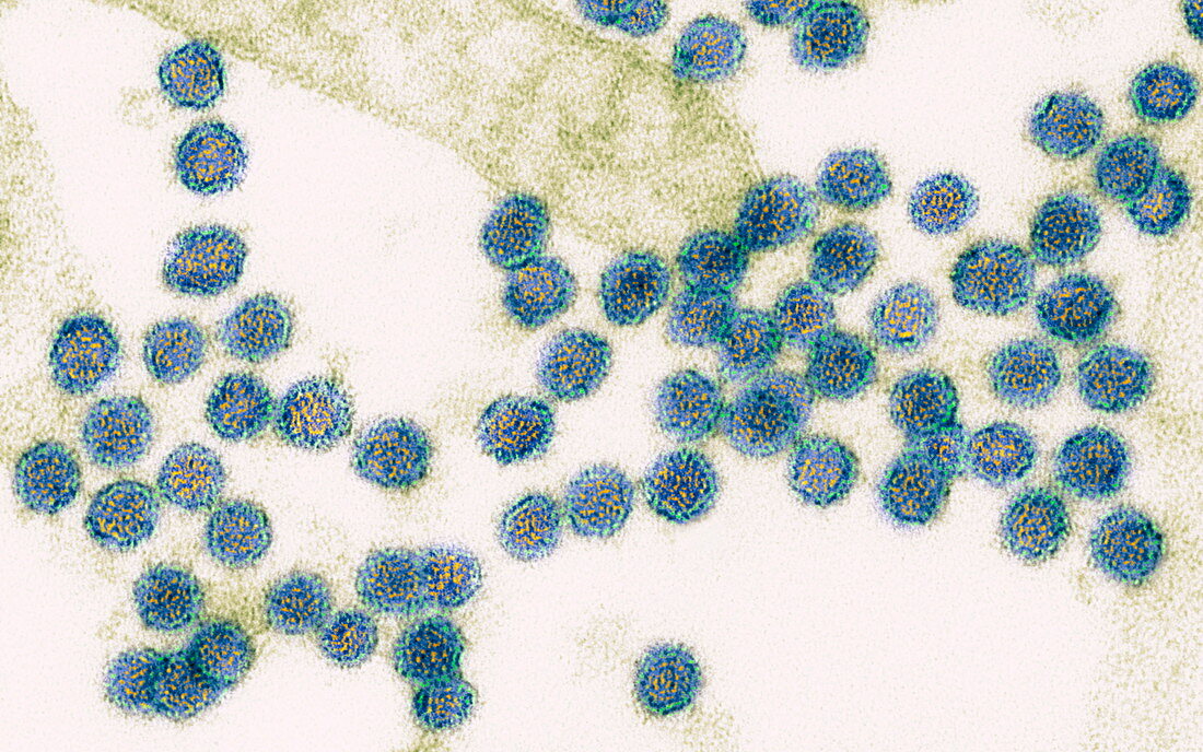 West Nile viruses,TEM