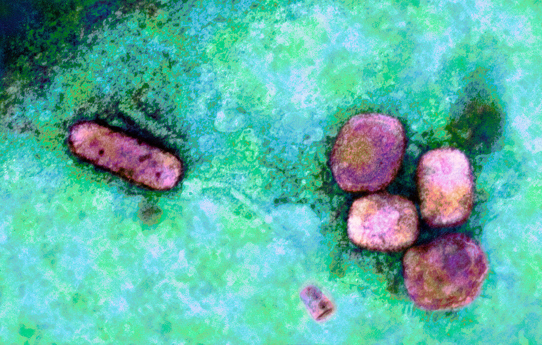 Smallpox virus particles,TEM