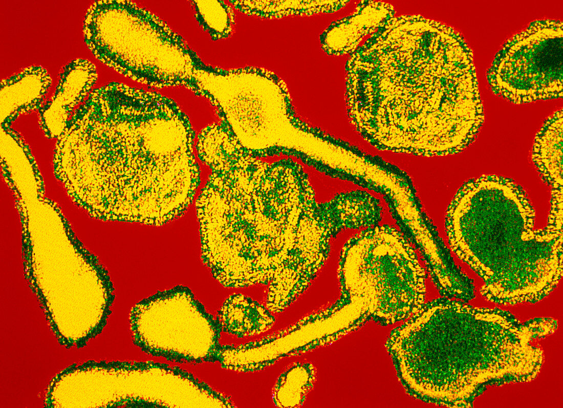Coloured TEM of respiratory syncytial (RSV) virus