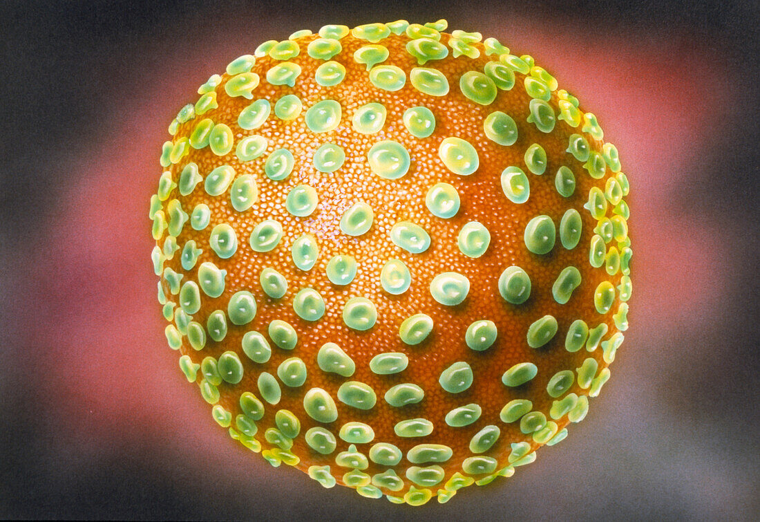 Illustration of an HIV virus