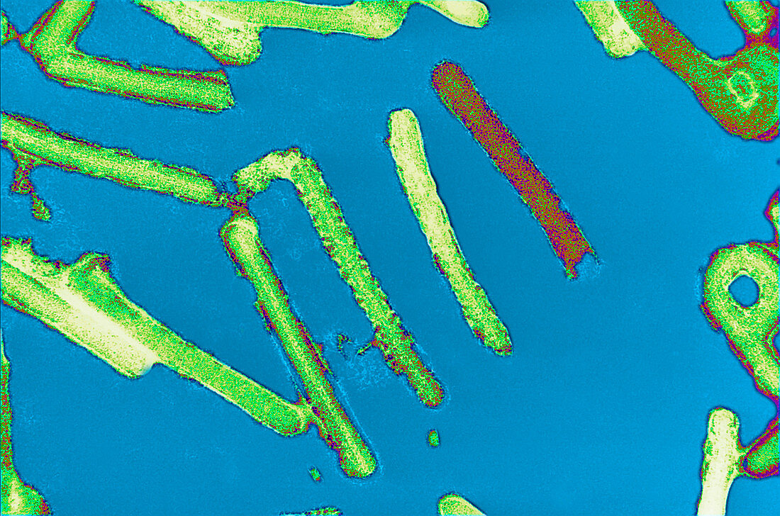 Coloured TEM of Marburg viruses