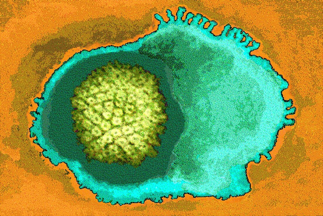 Coloured TEM of a herpes simplex type I virus