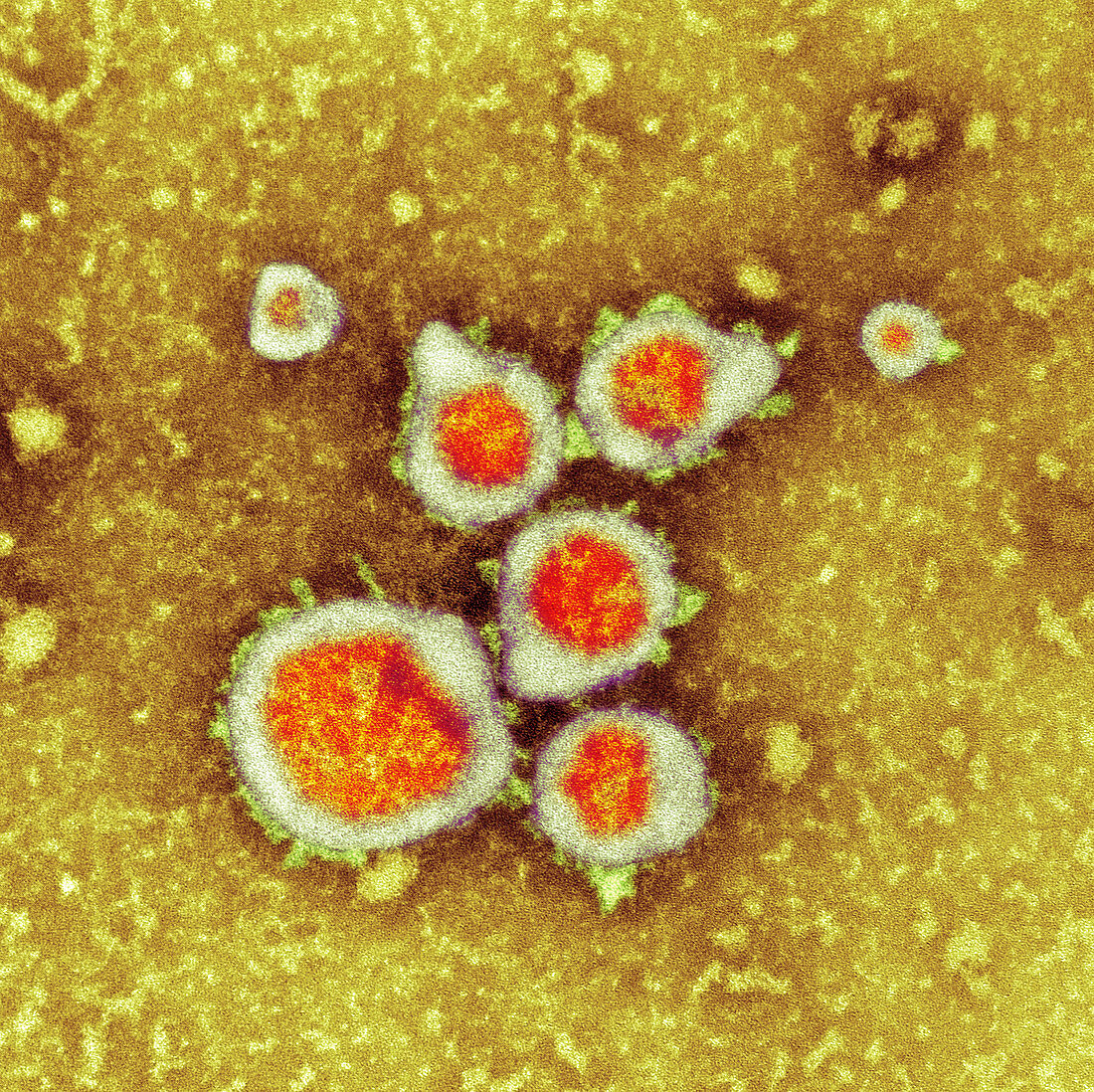 Respiratory syncytial virus,TEM