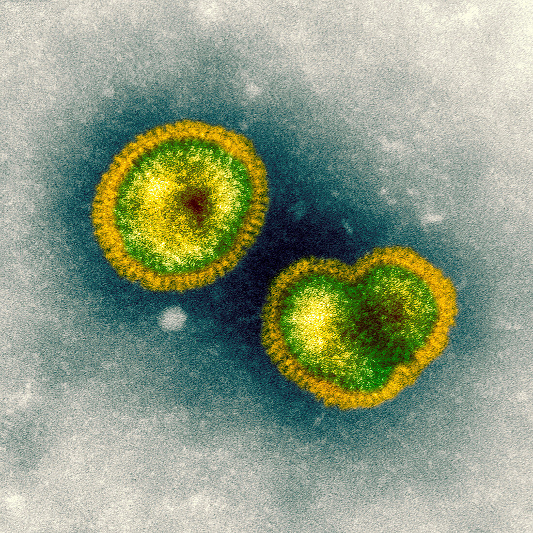 Influenzavirus B,TEM