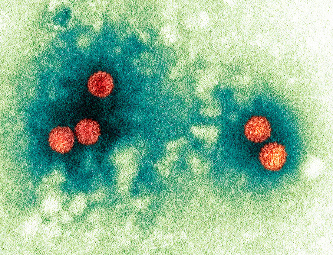 Polyoma virus particles,TEM