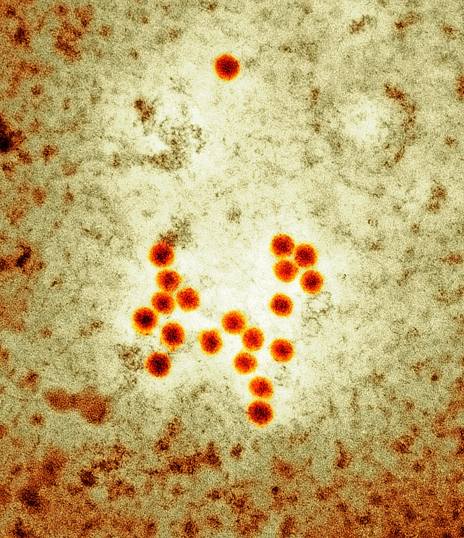Coxsackie virus particles,TEM