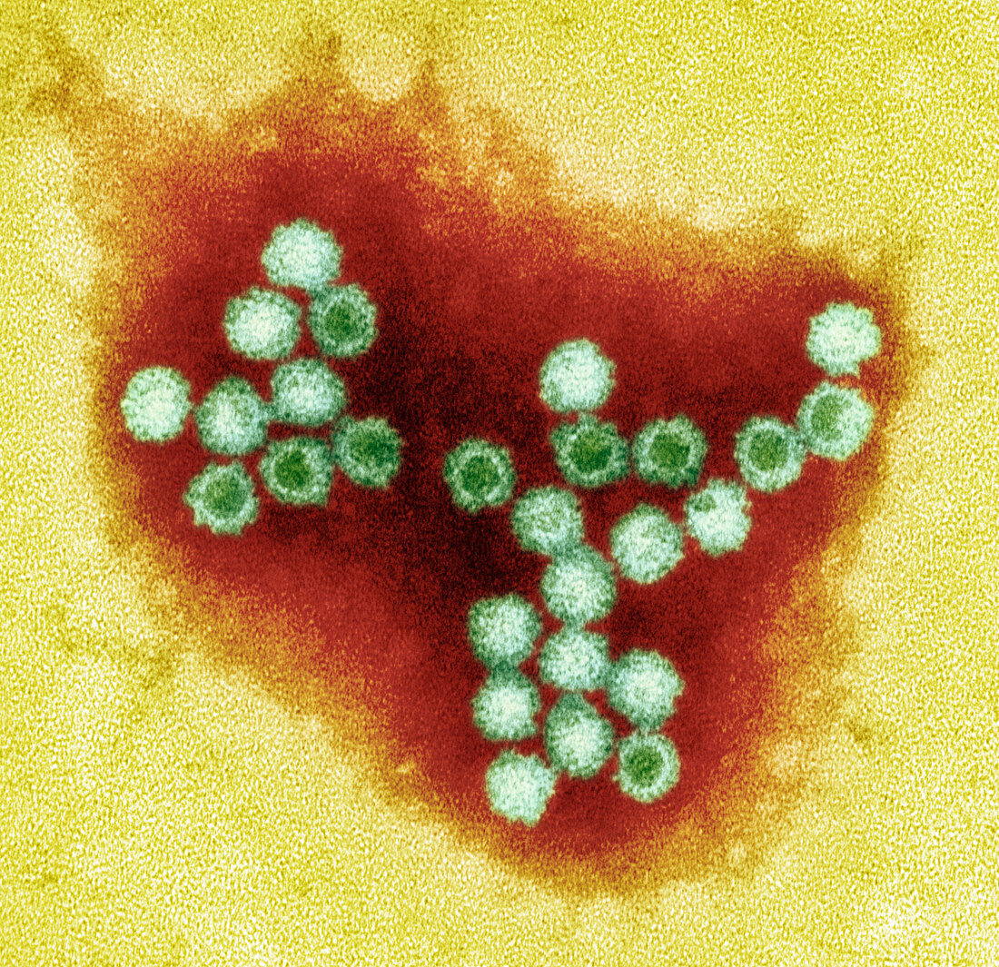 Norovirus particles,TEM