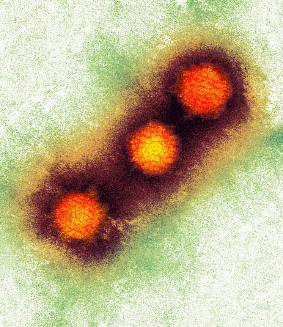 Herpes simplex virus particles,TEM