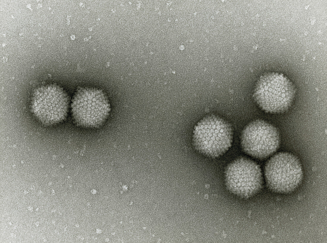 TEM of adenovirus particles