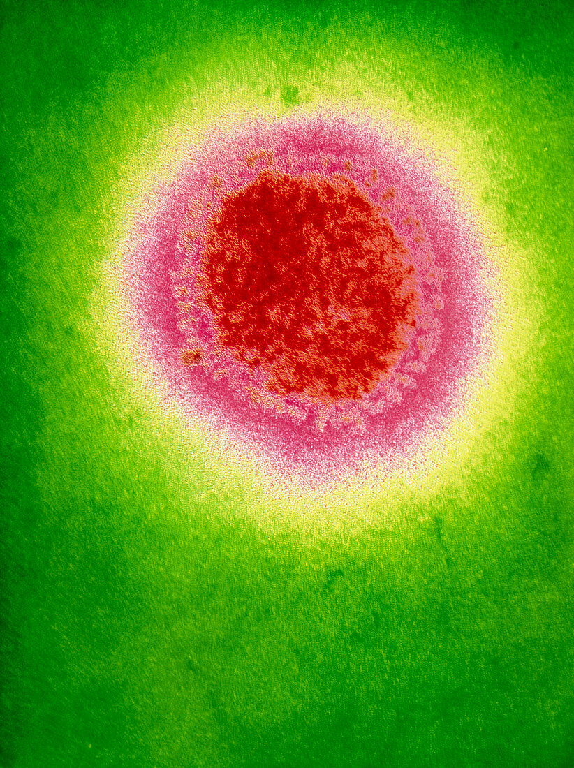 Coloured TEM of a single Beijing influenza virus