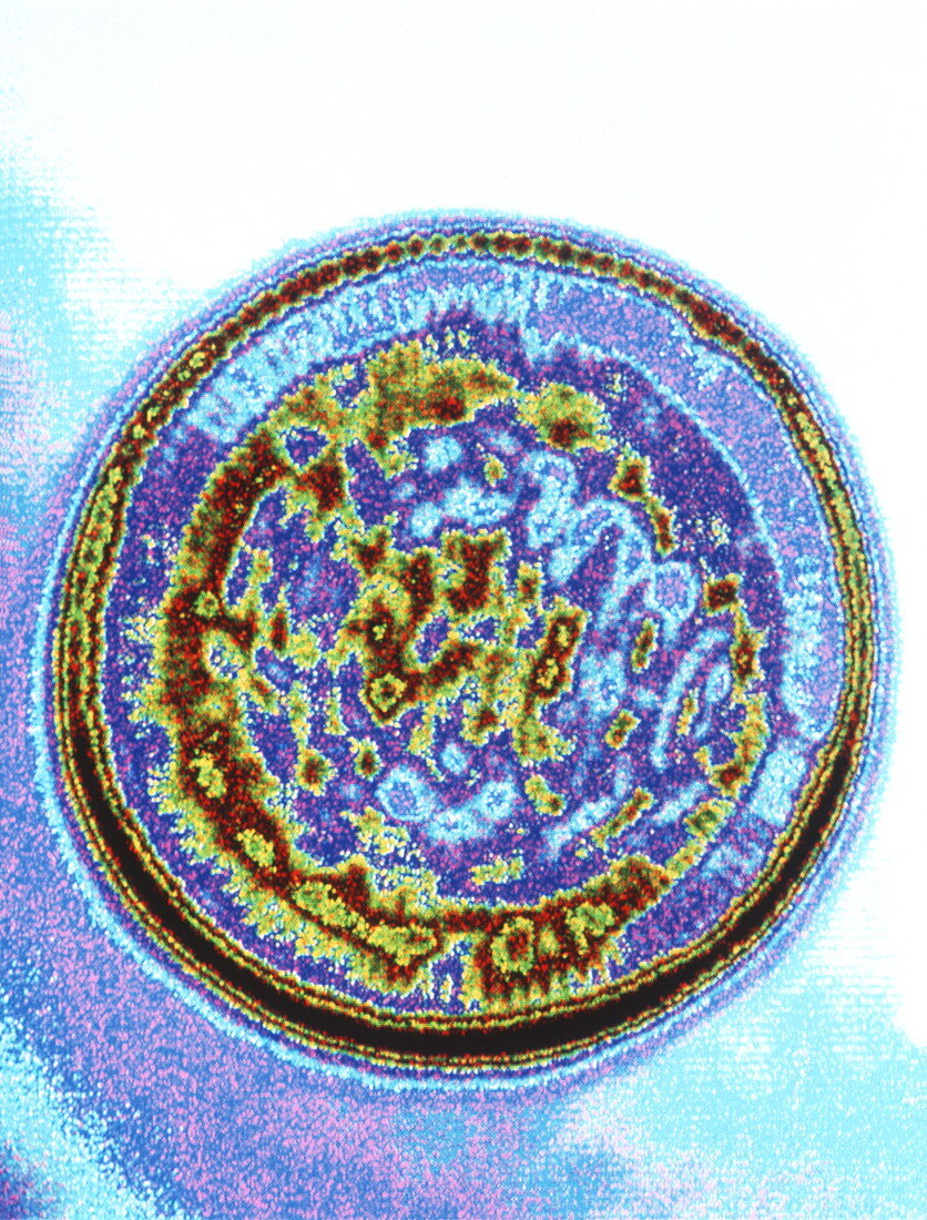 Computer graphic image of a rhinovirus particle
