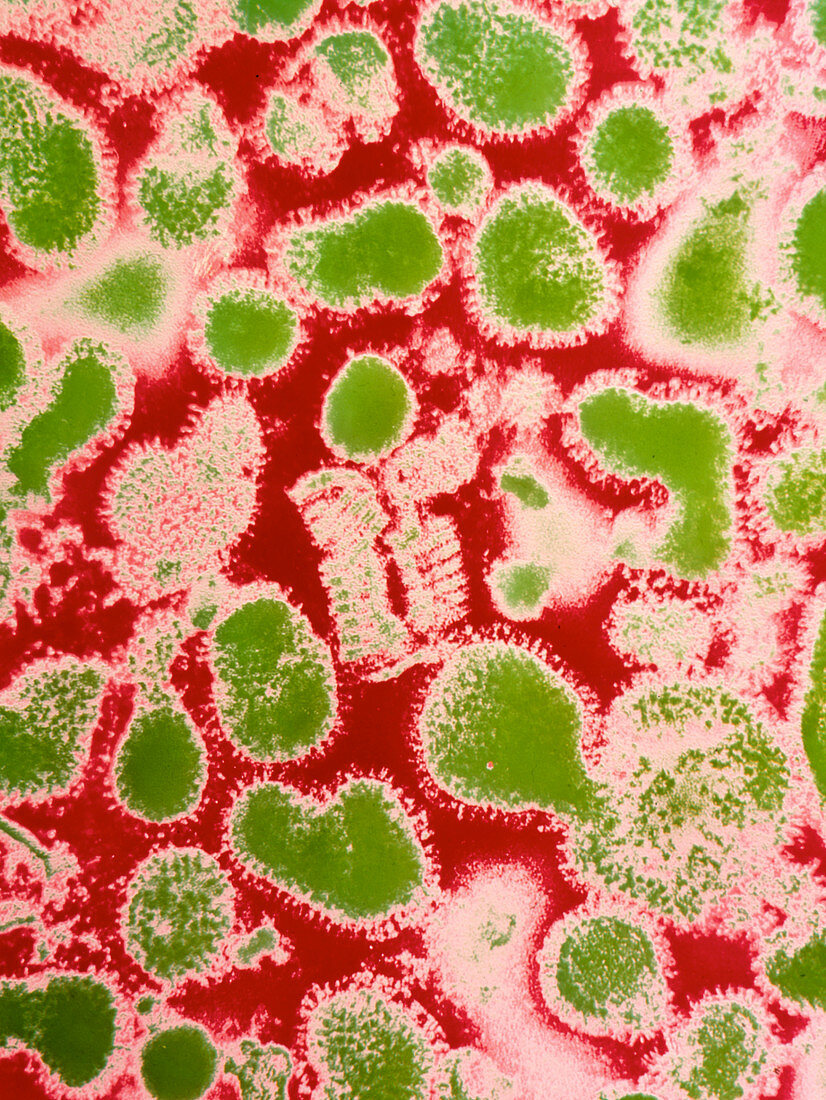 Coloured TEM of Asian flu viruses
