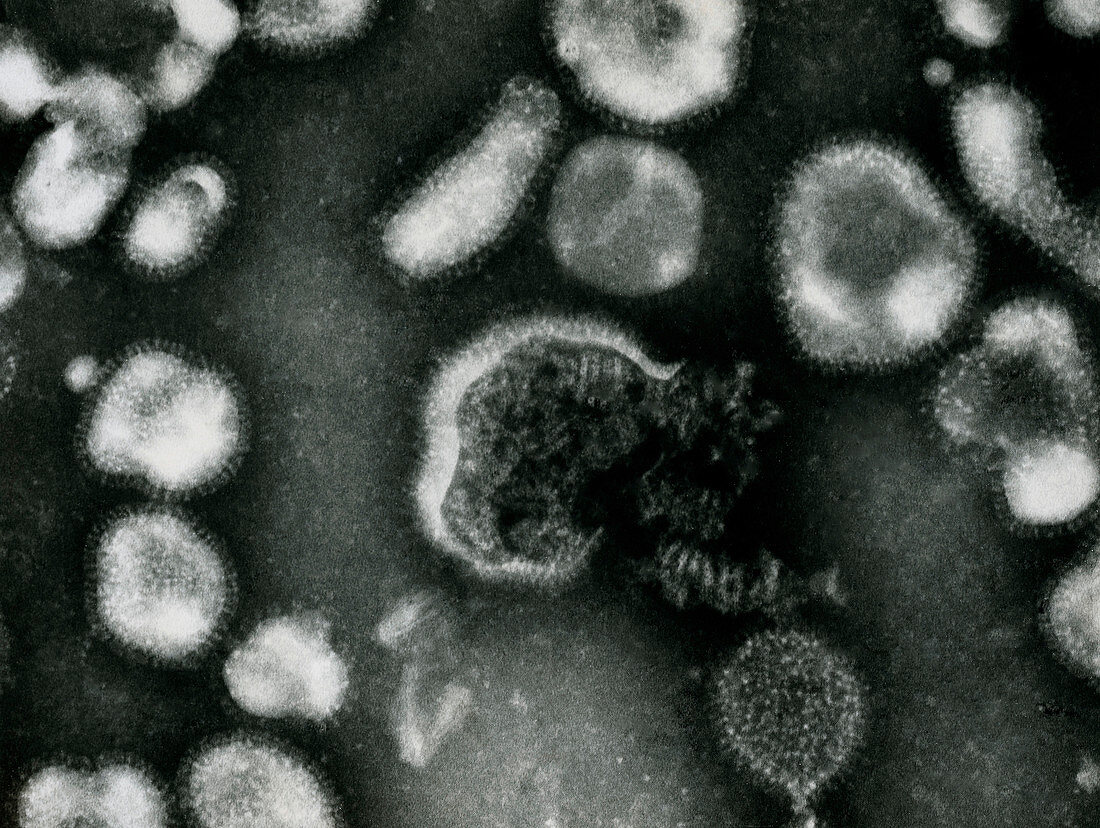 Electron micrograph of avian influenza viruses