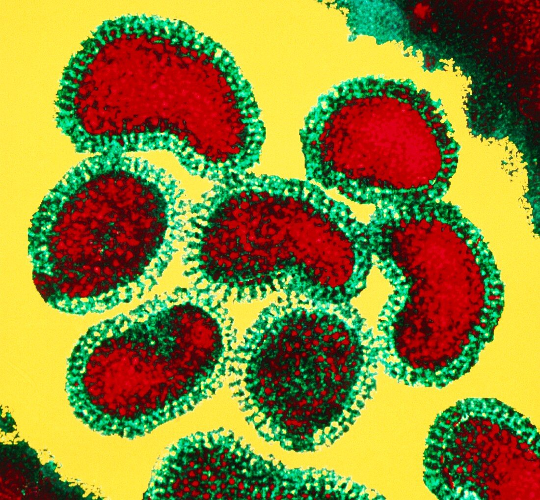 Coloured TEM of a cluster of influenza viruses