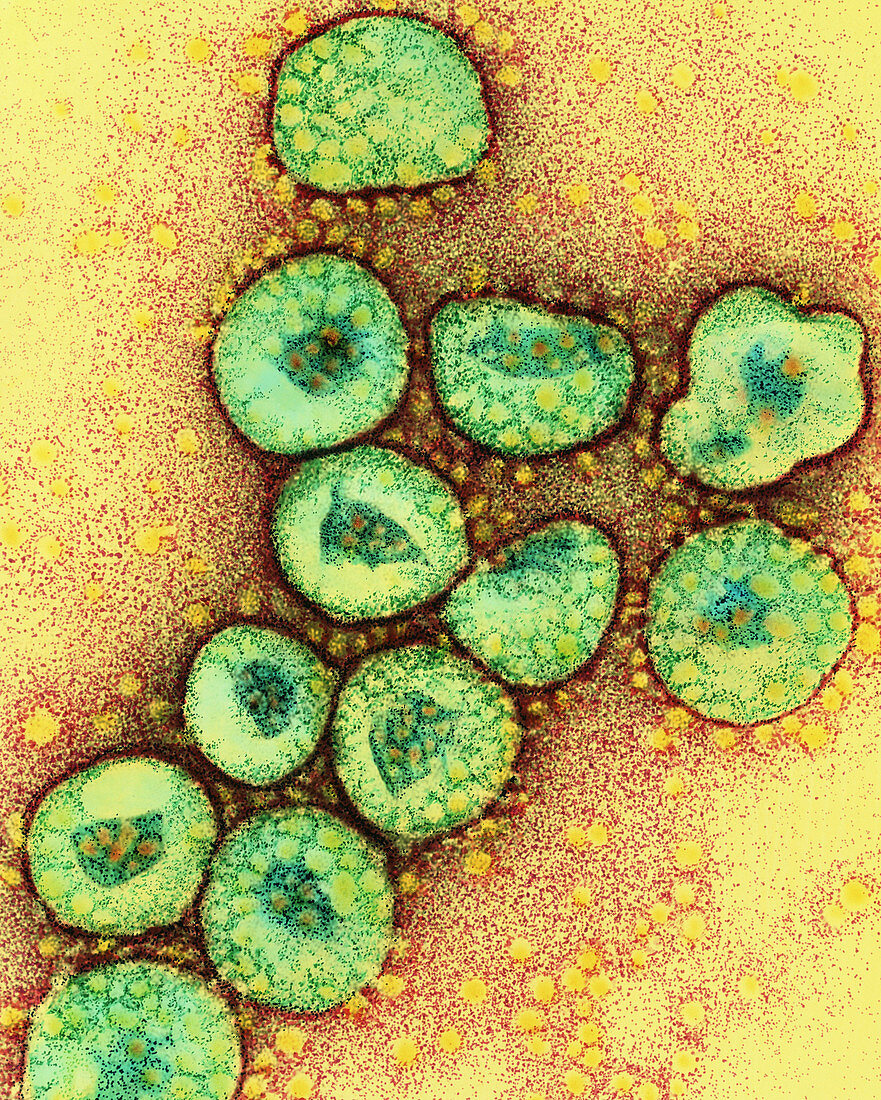 TEM of a cluster of corona viruses