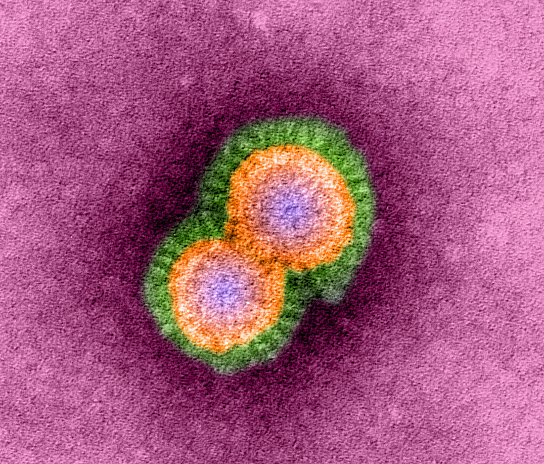 H5N1 avian influenza virus particles,TEM