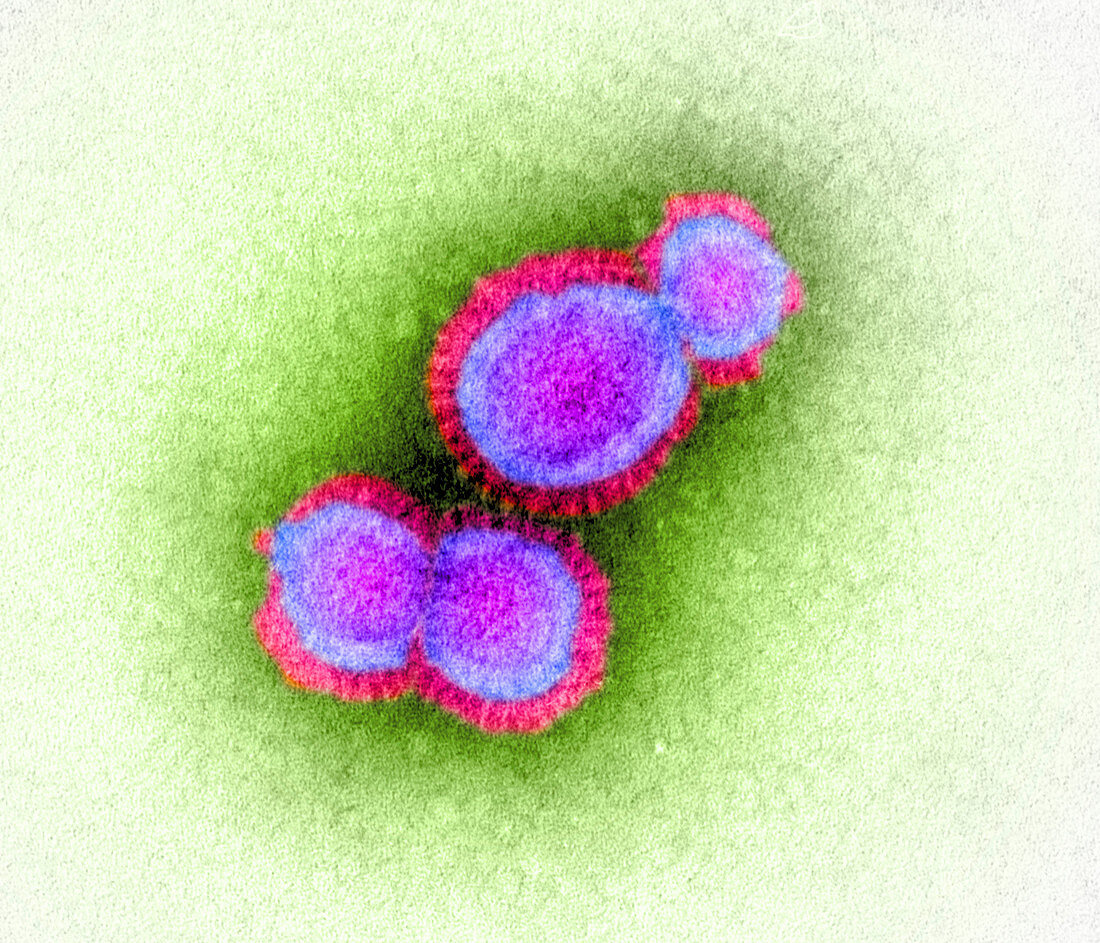 H5N1 avian influenza virus particles,TEM