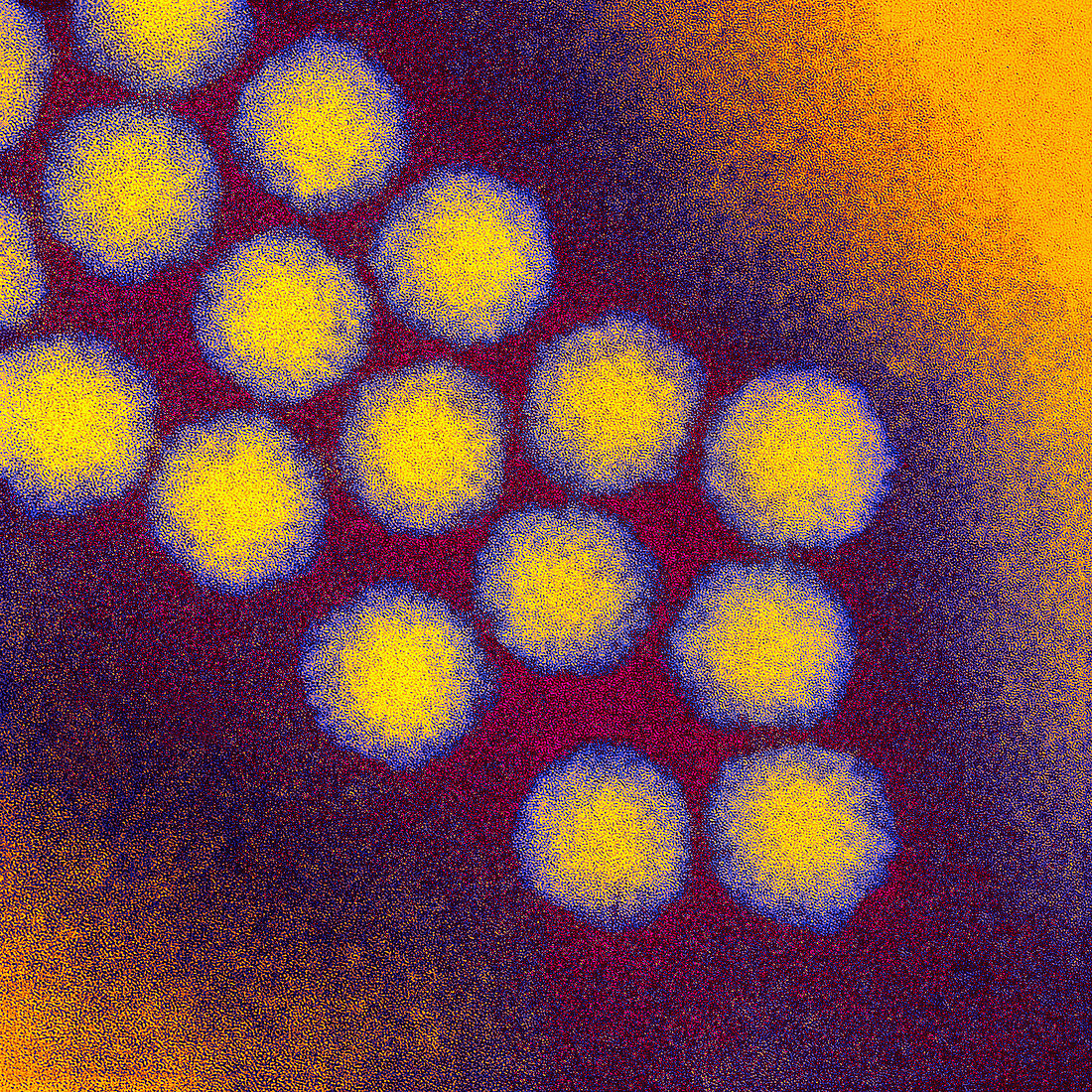 Poliovirus particles,TEM