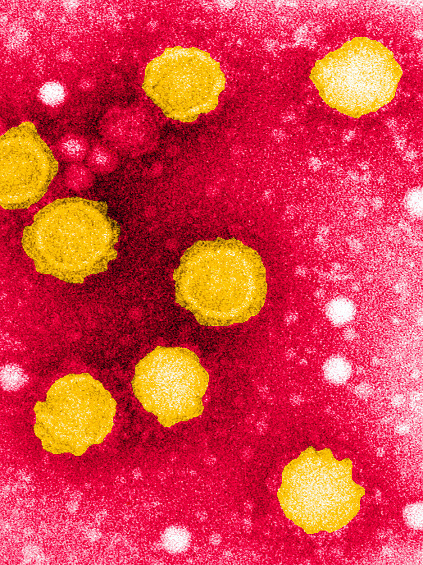 Chikungunya virus particles