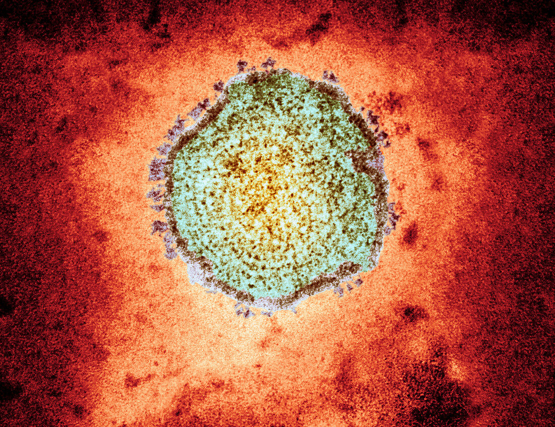 Mumps virus,TEM