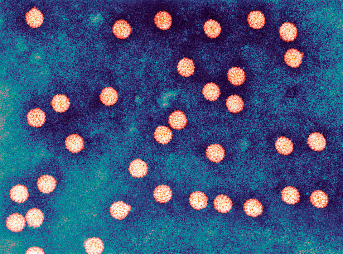 Papillomavirus virions,TEM