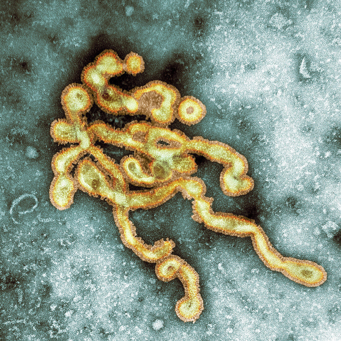 Influenzavirus C,TEM