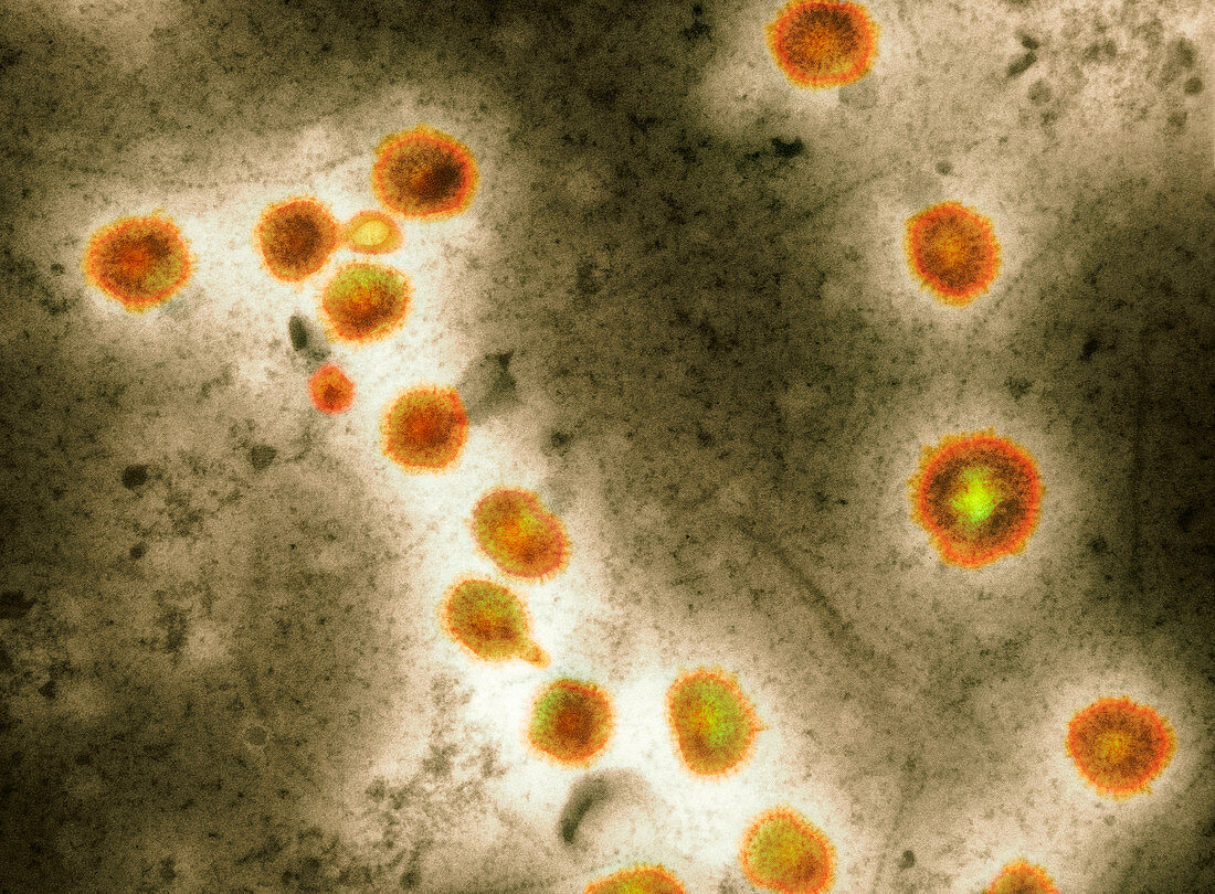 Avian influenza virus particles,TEM