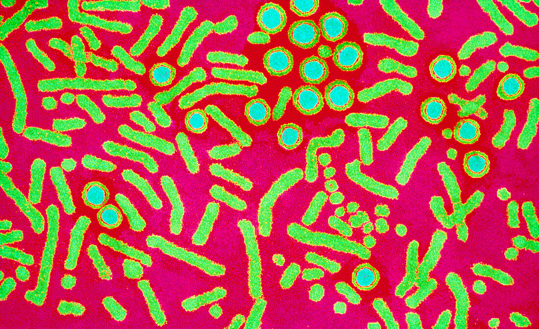 Coloured TEM of hepatitis B virus and its antigen