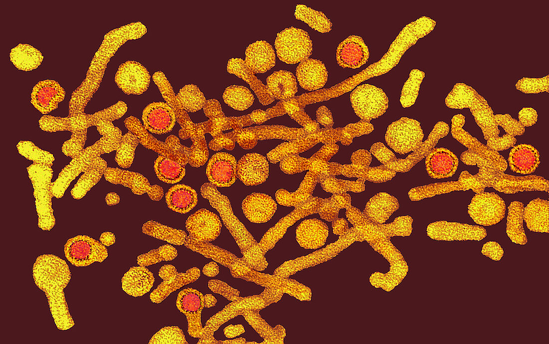 Coloured TEM of hepatitis B virus and its antigen