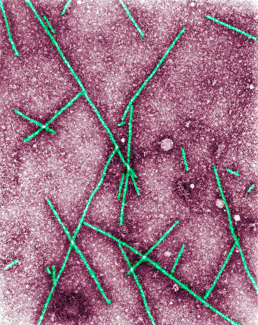 Barley yellow mosaic virus,TEM