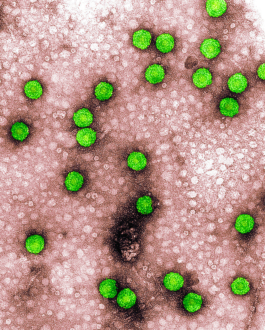 Cauliflower mosaic virus,TEM