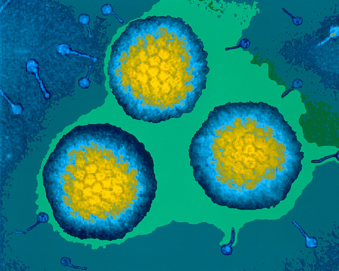 Coloured TEM of three adenoviruses