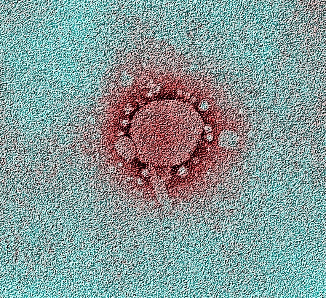 Coronavirus,TEM