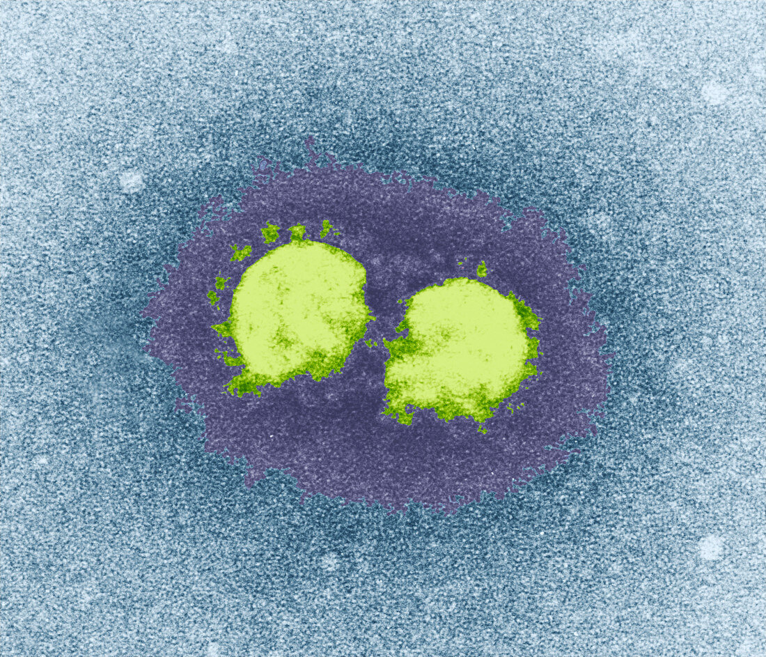 SARS virus particles,TEM