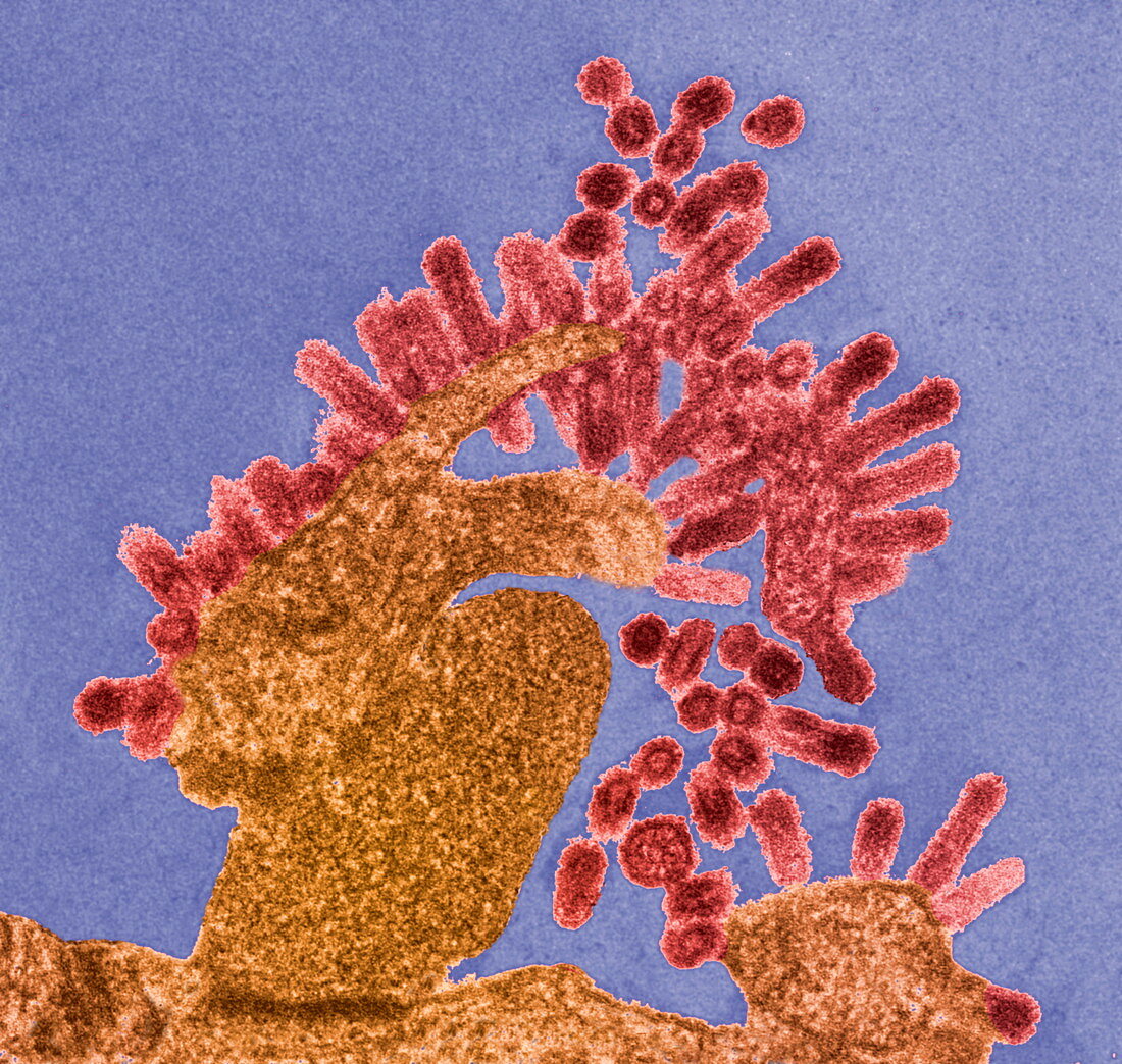 Influenza viruses,TEM