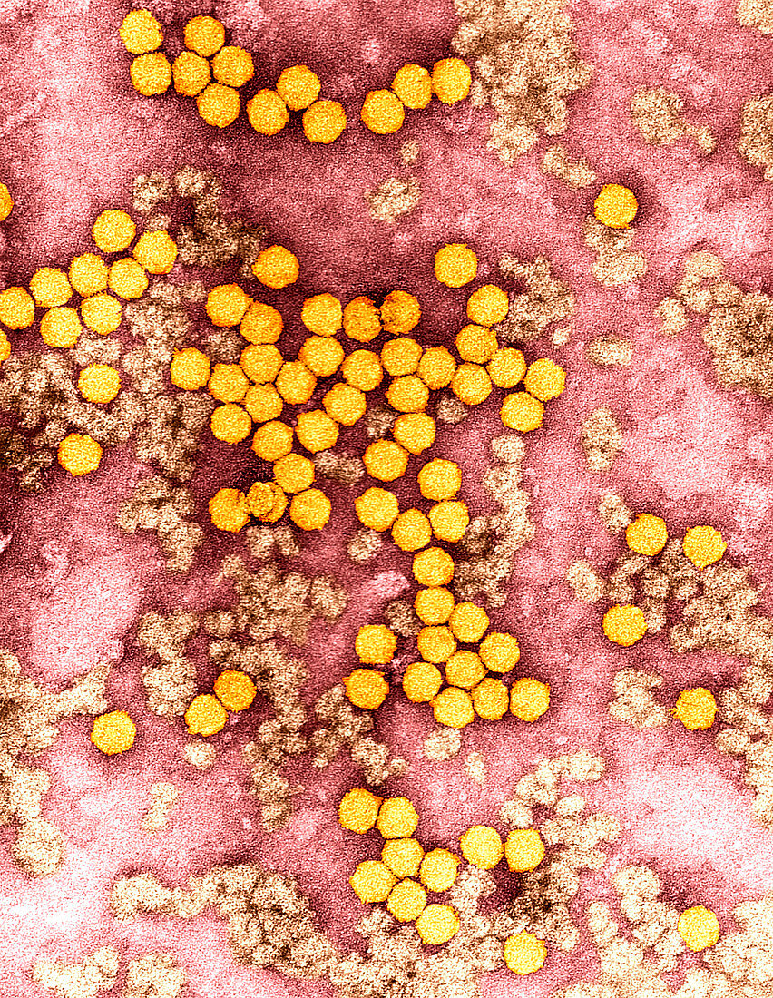 Parsnip yellow fleck virus,TEM