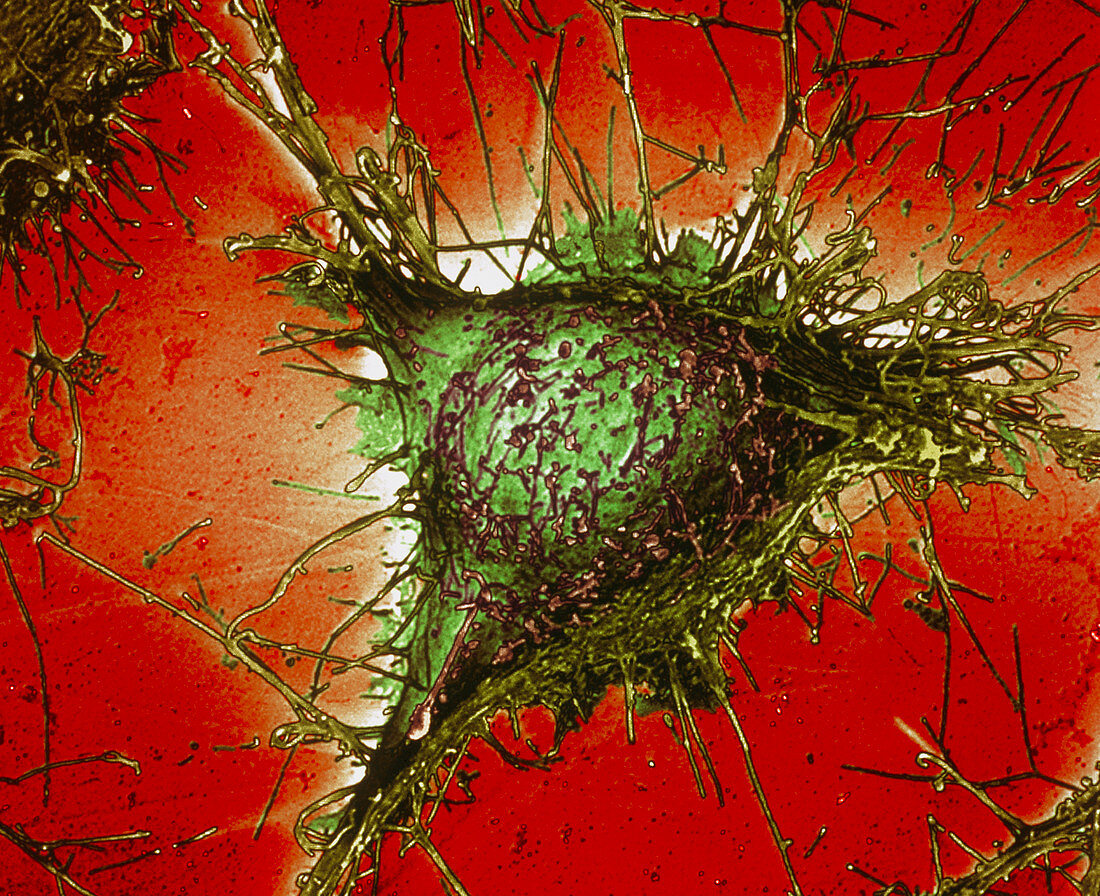 Alzheimer's disease culture cell