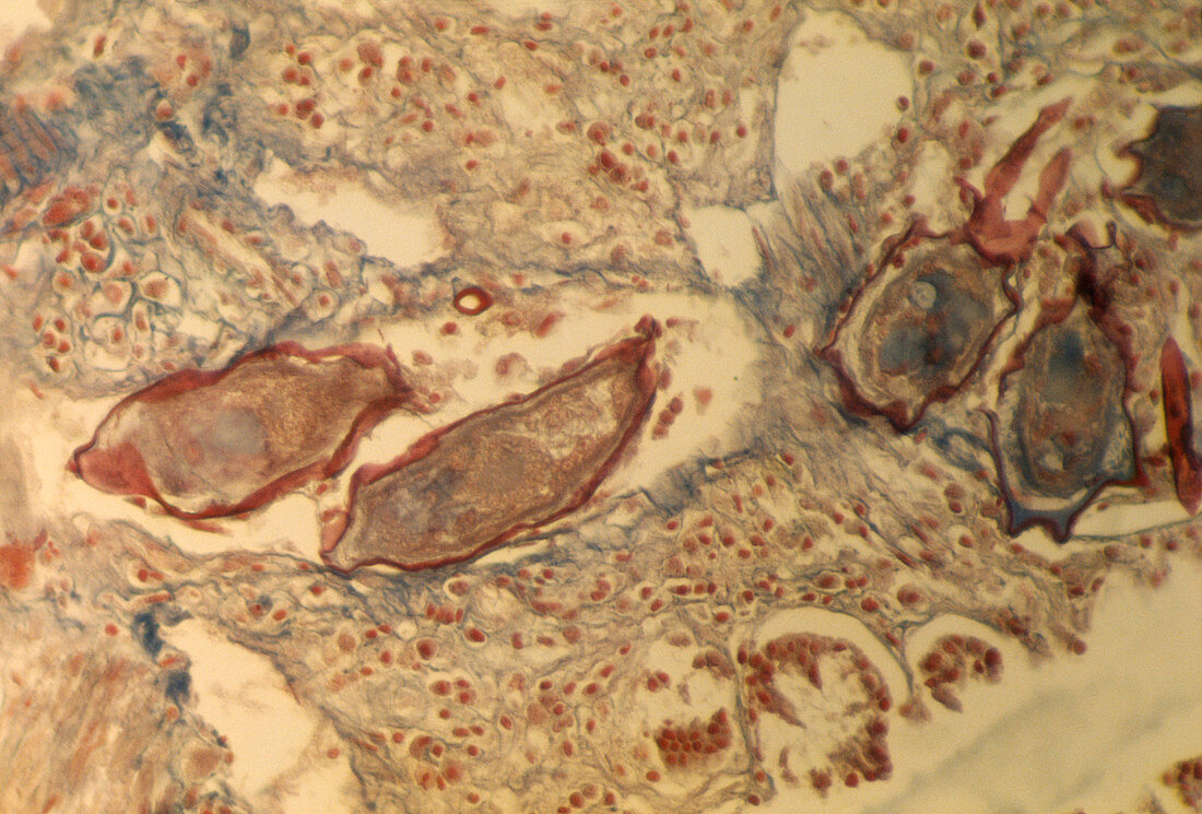 Schistosome parasite eggs