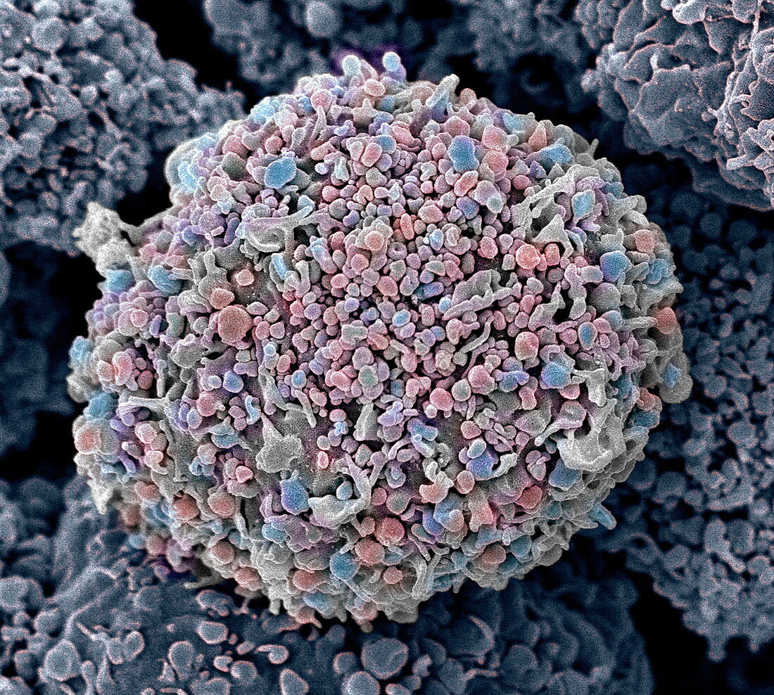 Breast cancer cell,SEM