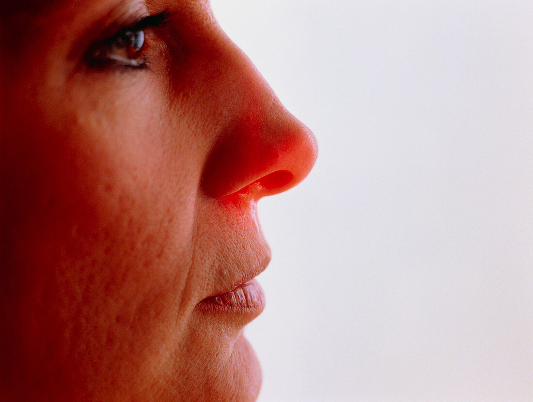 Rhinitis: profile of a woman's running nose